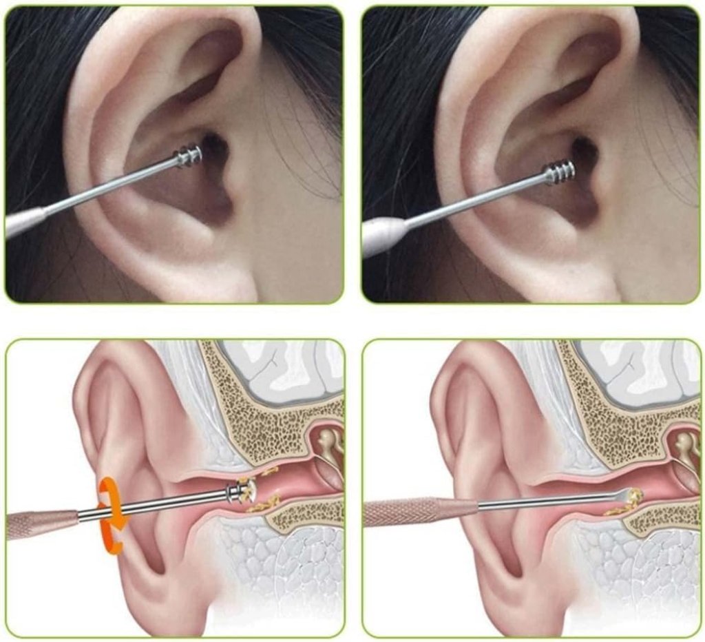 6 in 1 Ear Wax Cleaner set Personal Care